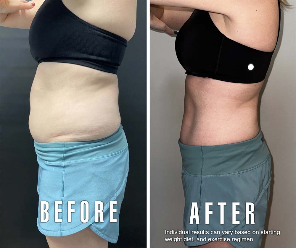 Find Semaglutide Near Me: Expert Insights & Availability